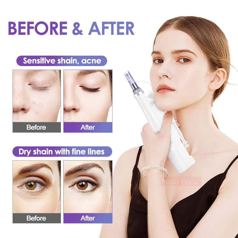 Portable Hydra Whitening Facial Mesotherapy Injector